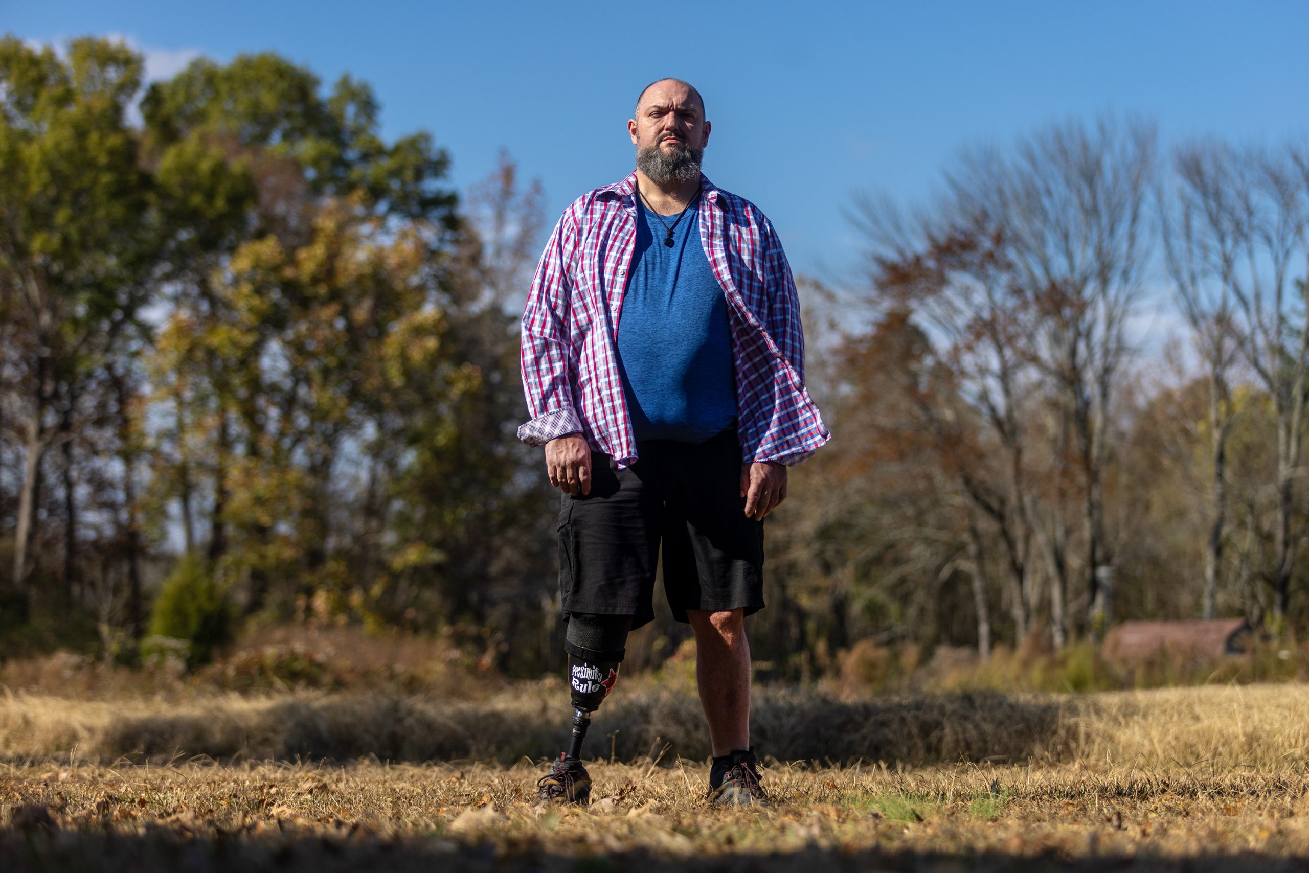 How Medicaid expansion could have saved Tim’s leg — and changed his life