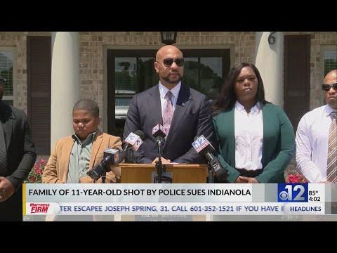 11-year-old boy says he thought he would die after Mississippi police officer shot him