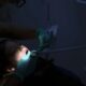 Hospitals limit pediatric dentists’ access for procedures that require anesthesia