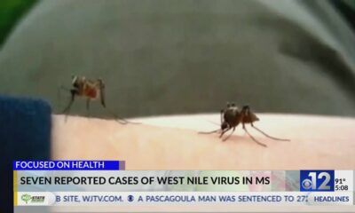 Mississippi reports seven human cases of West Nile Virus