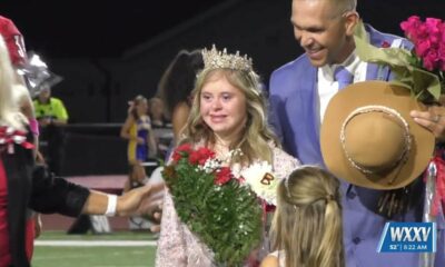 Biloxi cheerleader with special needs honored after being named Homecoming Queen