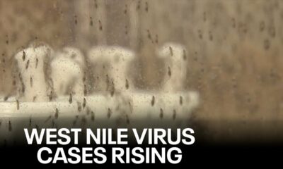 West Nile Virus cases rising in Dallas County