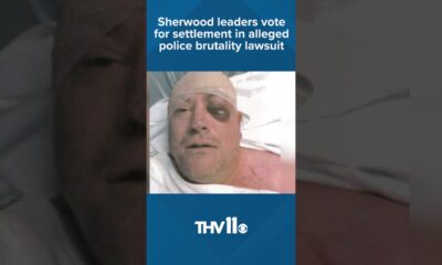 Sherwood man files lawsuit after alleged police brutality causes brain injury