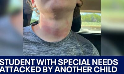 Student with special needs attacked, mother says | FOX 7 Austin