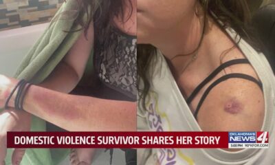 Domestic violence survivor shares her story