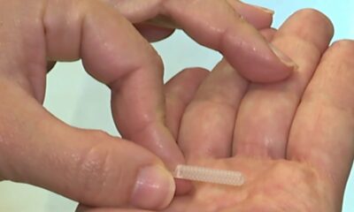 Rice University says new implant could lower cost of popular weight loss drugs