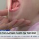 CDC sees spike in 'walking pneumonia' cases among children