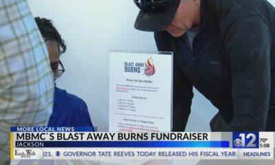 MBMC`s Blast Away Burns fundraiser