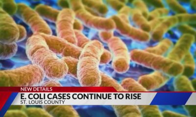 E. coli cases continue to rise following St. Louis County outbreak