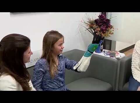 Girl receives Moana-themed prosthetic arm, thanks to Disney and Open Bionics