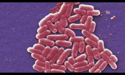 E. coli outbreak that sickened more than 100 in St. Louis area now linked to 6 other states