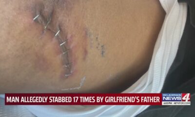 Man allegedly stabbed 17 times by girlfriend's father