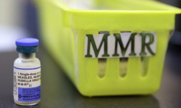 Potential measles exposure reported in San Antonio, San Marcos