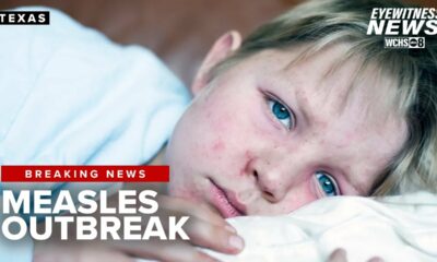 Measles exposure alert issued for Texas after visitor tests positive