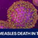 Measles: Texas child dies from virus | FOX 7 Austin