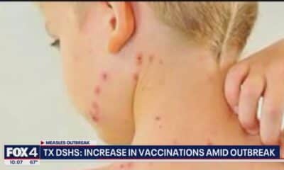 Texas measles outbreak 2025: More new cases detected in West Texas