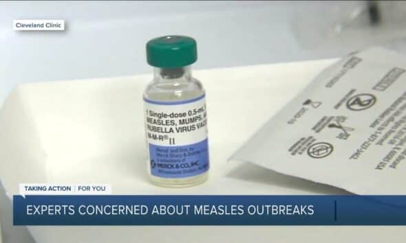 Measles case in Florida being monitored