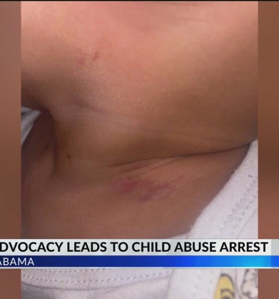 EXCLUSIVE: Prichard mother relieved after day care worker accused of abusing son is arrested