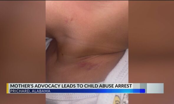 EXCLUSIVE: Prichard mother relieved after day care worker accused of abusing son is arrested